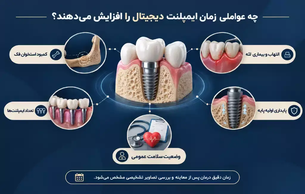 چه عواملی مدت زمان ایمپلنت دیجیتال را افزایش می دهند؟
