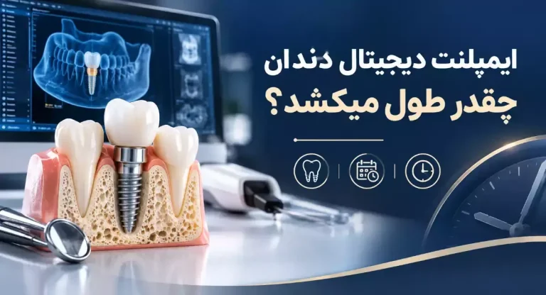 ایمپلنت دیجیتال چقدر زمان میبرد؟ بررسی مدت زمان هر مرحله از درمان